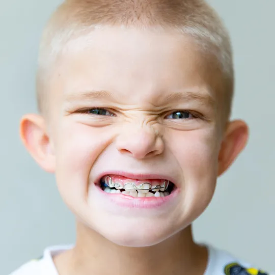 Early Orthodontic Treatment